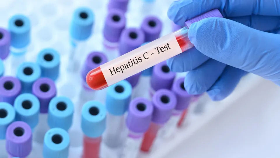 Mortalidade por hepatite viral atinge 1 a cada 5 pacientes com 80 anos no SUS